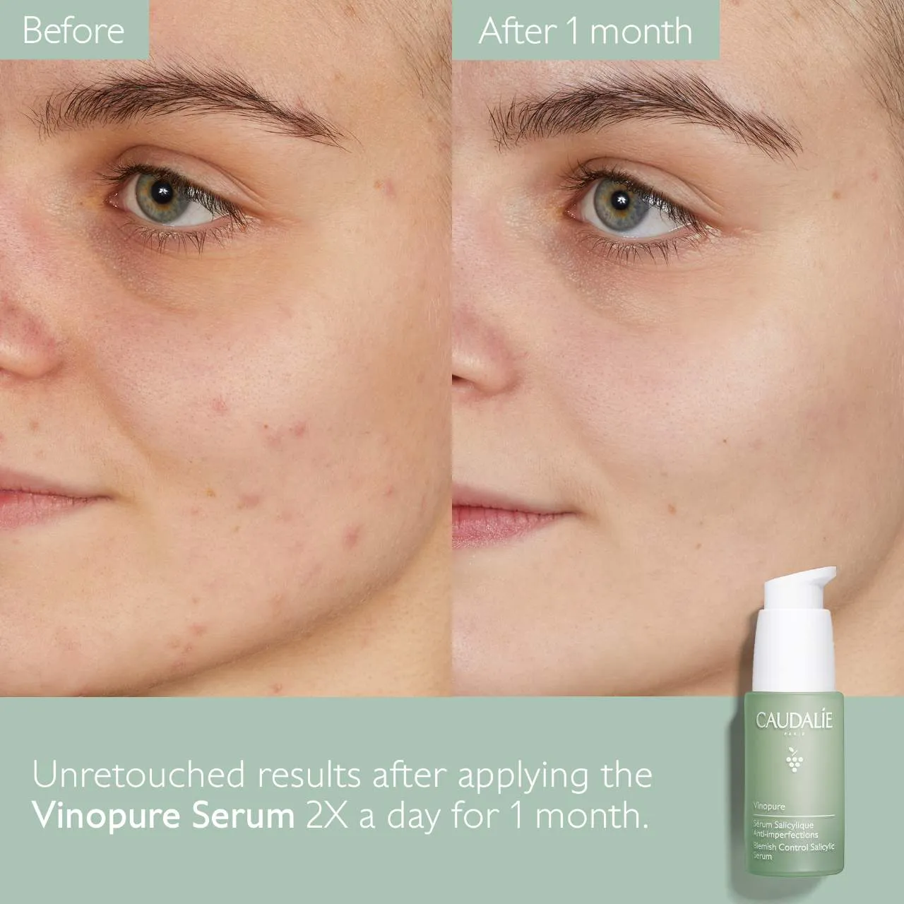 Caudalie  Vinopure Natural Salicylic Acid Pore Minimizing Serum 30ml NIB
